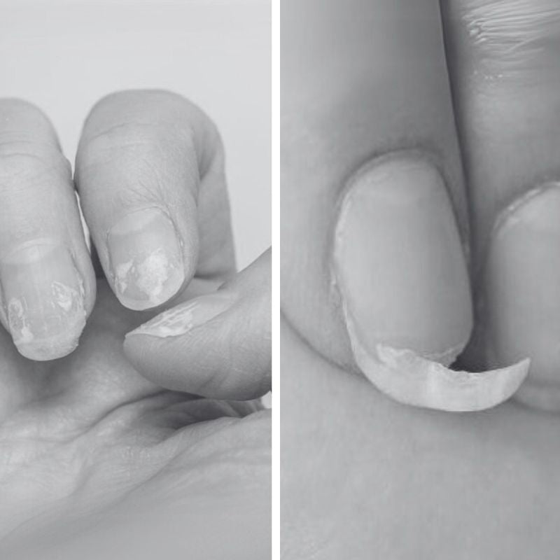 Fingernails with peeling and lifting nail polish; one nail tip partially detached.